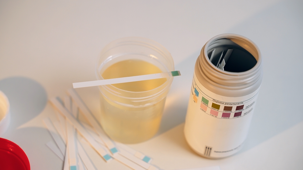 Image for Low Ketone Management Flowchart for Hybrid Close Loop Users